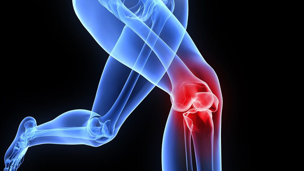 Problemas no xeonllo debido á artrose